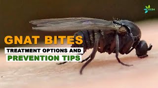 How to Treat Gnat Bites  Treatment Options and Prevention Tips [upl. by Telrahc]