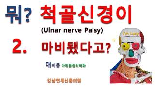 Ulnar nerve palsy 검사 및 치료 [upl. by Aivatnwahs]