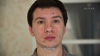 Management of Acne Vulgaris  An Educational Video by Radium Medical Aesthetics [upl. by Aerol]