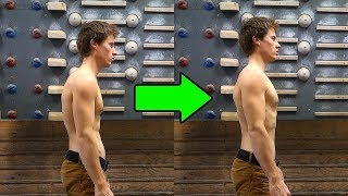 Correcting Climbers Back 3 Exercises [upl. by Gorton832]