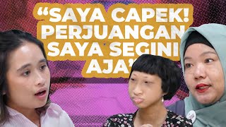 SECKEL SYNDROME KONDISI LANGKA HANYA ADA 6 DI INDONESIA  GritteBukaPraktek [upl. by Viradis95]