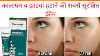 Bleminor anti blemish cream review in Hindi  झाइयां हटाए रंग निखारे [upl. by Vasya628]