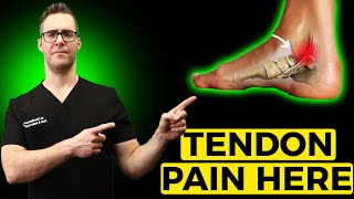 Posterior Tibial Tendonitis Treatment Inside of the Ankle Pain [upl. by Okuy]