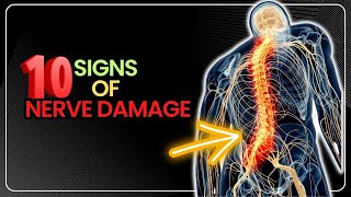 10 Symptoms and Signs of Nerve Damage You Should Never Ignore [upl. by Rostand]