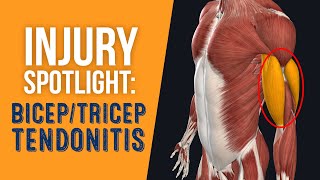 Injury Spotlight Bicep amp Tricep Tendonitis [upl. by Enitsirk775]