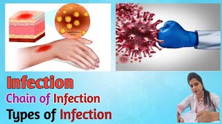 Infection I Types of Infection I Chain of Infection I Infection control Nursing I Prevention [upl. by Normandy]