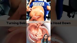 turning baby from breech to head down sandhyahealth  ulate bachhe ko shidha kaise kare [upl. by Bluh]