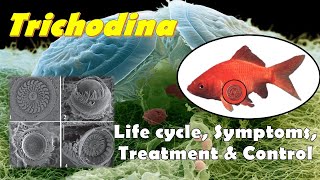 Trichodina sp Morphology Life cycle Symptoms Treatment and Control Methods [upl. by Wertz]