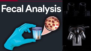 Fecalysis MICROSCOPIC STOOL ANALYSIS STEP BY STEP GUIDE MEDICAL LABORATORY SCIENCE [upl. by Hsina638]