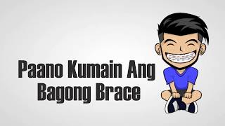 Paano Kumain ang bagong brace [upl. by Caye]