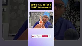 Graft choice for ACL knee surgery  shorts acl [upl. by Ydnolem174]