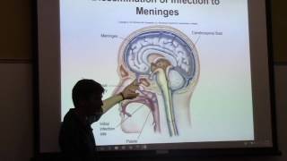 Microbiology  Infectious Diseases Affecting The Nervous System  CH 19 [upl. by Cybil]