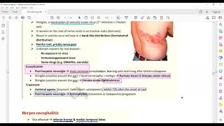 Plab 1 Lectures Dermatology Part 8 Herpes SimplexHerpes ZosterMolluscum Contagiousm [upl. by Inneg576]