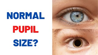 Are your pupils normal size [upl. by Maillliw]