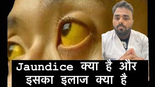 Jaundice क्या है और इसका कारण क्या है और इसका इलाज क्या है jaundice patient awareness doctor yt [upl. by Crandall639]