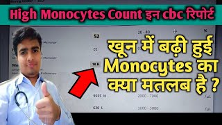 Monocytes High In Blood Test Monocytes In Hindi High Monocyte In Blood Cbc test [upl. by Analah]