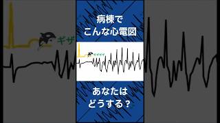 病棟でこんな心電図あなたはどあする？part2 心電図検定 看護師 [upl. by Mychal442]