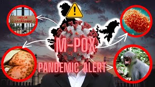 MPOX VIRUS another pandemic after corona virus news [upl. by Barbabra]