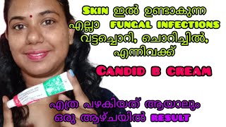 candid b cream for skin fungal infections  candid b ointment review malayalam [upl. by Mildrid595]