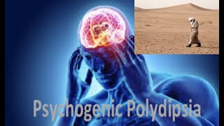 Psychogenic Polydipsia Water Intoxification [upl. by Ddot584]