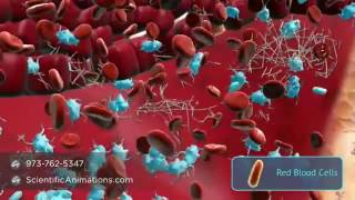 Angiogenesis Formation of new blood vessels [upl. by Enella]