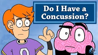 Do I Have a Concussion [upl. by Carmella]