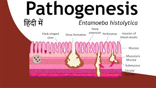 Pathogenesis of Entamoeba histolytica in Hindi  Parasitology Hindi  Basic Science Series [upl. by Medeah]