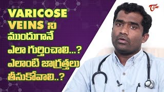 What Is Varicose Veins amp How Can It Be Treated   Dr Shailesh Kumar Garge  TeluguOne [upl. by Punke]