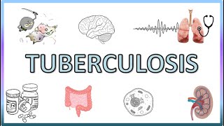 Tuberculosis  Types Pathogenesis Signs and Symptoms Diagnosis Treatment and Prevention [upl. by Adnirim]