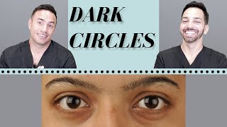 Dark Circles Causes amp Treatments  Dermatologist Perspective [upl. by Enniotna]