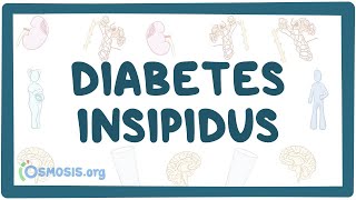 Diabetes insipidus  causes symptoms diagnosis treatment pathology [upl. by Konstantine]