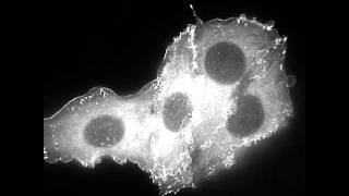 Focal adhesions form during lamellipodial protrusion and are essential for cell spreading [upl. by Annaliese]