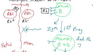 Hemolytic anemia of newborns [upl. by Anny]