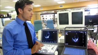 Expert Comparison Test Sonoscape S9 vs GE Vivid Ultrasound Systems  Drs Toy Store [upl. by Stilwell847]