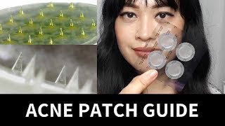 Guide to Acne Patches Hydrocolloid Treatment Microneedle  Lab Muffin Beauty Science [upl. by Gnouv]