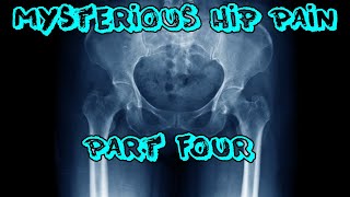 Mysterious Hip Pain  Part 4 [upl. by Lora]