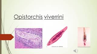 Clonorchis sinensis y opistorchis viverrini [upl. by Art]