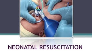 NEONATAL RESUSCITATION PEDIATRICS BSc NURSING GNM medical nursing physiology pediatrics [upl. by Hctub]