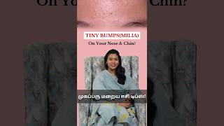 Tips to get Rid of Tiny Bumps on Your Face 😲 Skincare தமிழ் draishwaryaselvaraj skincare [upl. by Imuyam]