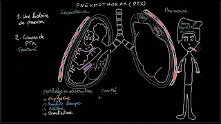 Pneumothorax  Docteur Synapse [upl. by Della199]