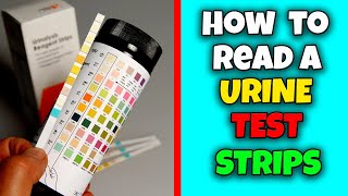 How to read Urine test strips  Health Educare [upl. by Josie45]