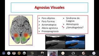 Las agnosias [upl. by Monahon]