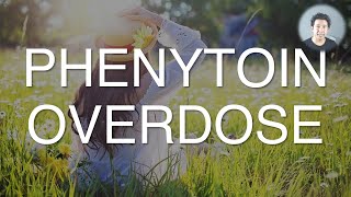 Phenytoin overdose and poisoning Not that bad [upl. by Stefano949]