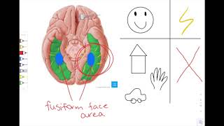 The Reason Why A 28000 Grilled Cheese Exists The Fusiform Gyrus [upl. by Atimed508]