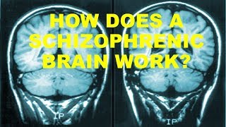 How does a Schizophrenic brain work [upl. by Aicilev832]