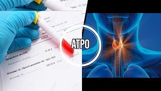 تحليل مضادات اجسام للبيروكسيداز الدرقيAnticorps antithyroperoxydase  ATPO [upl. by Arodasi]