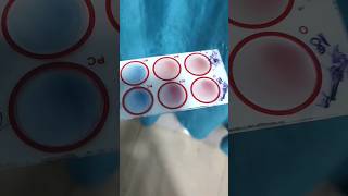 Agglutination test mixing procedure [upl. by Adamok]