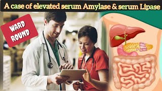 A case of pancreatitis Elevated serum Amylase amp serum lipase causes of elevates digestive enzymes [upl. by Areik855]