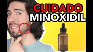 CUIDADOS AL USAR MINOXIDIL  JM Montaño [upl. by Nerwal]