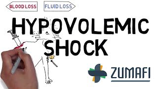 Hypovolemic shock  Introduction amp Causes [upl. by Eyk]